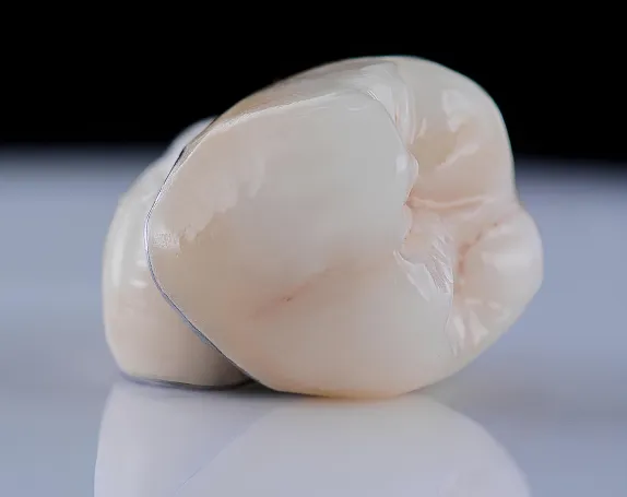 Dental Crowns at Smile Breeze Dentistry