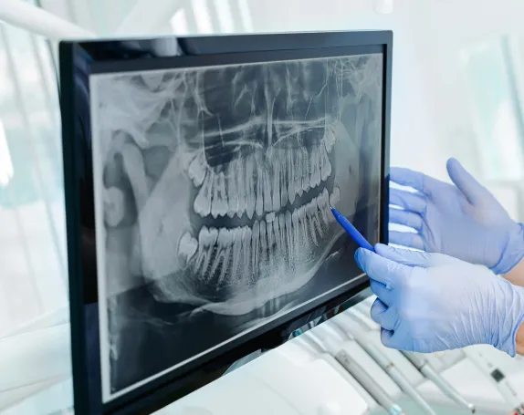 Digital X-Rays at Smile Breeze Dentistry