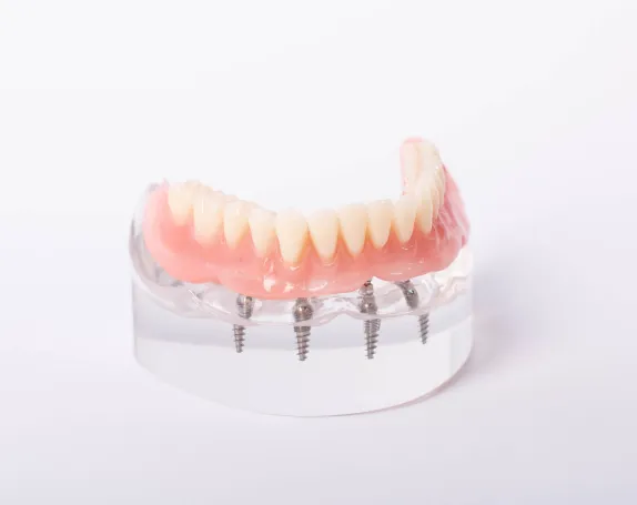 ImplantSupportedDentures at Smile Breeze Dentistry