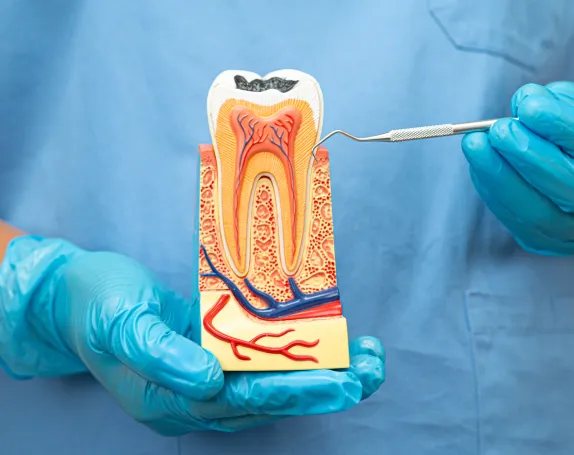 Pulpotomy at Smile Breeze Dentistry