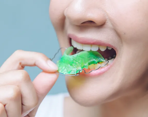 Retainers at Smile Breeze Dentistry