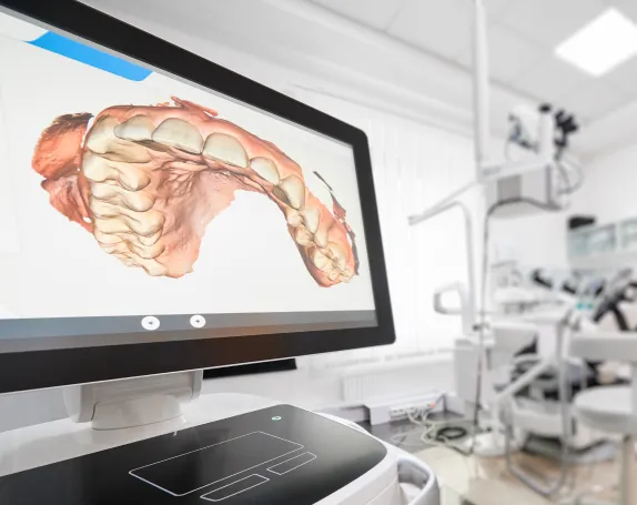 iTero® Digital Scanning at Smile Breeze Dentistry